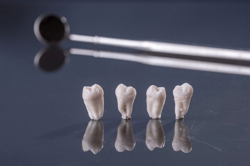 Vier Weisheitszähne dahinter Zahnarztinstrument Spiegel
