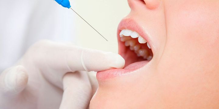 Spritze beim Zahnarzt zur örtlichen Betäubung