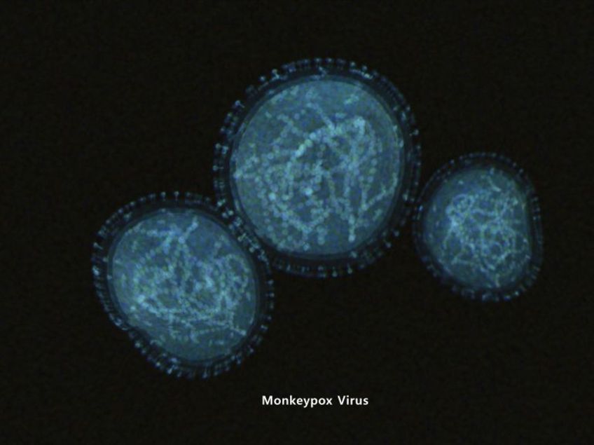 So sieht das Affenpocken-Virus aus