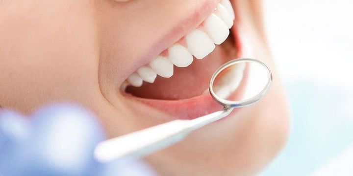 Frau beim Zahnarzt - Nahaufname des Mundes